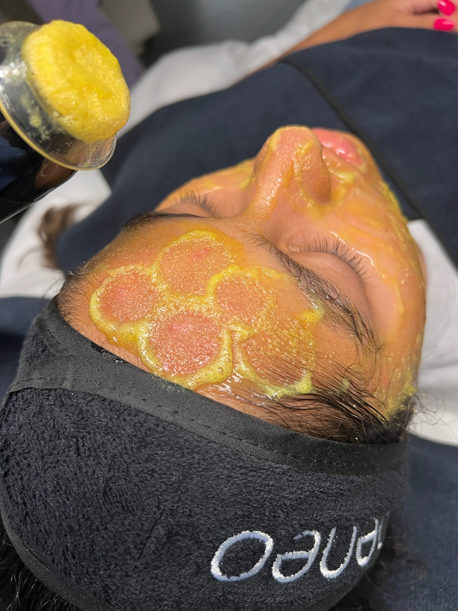 IMG_6631 A close-up of a skincare treatment, showcasing a device applying a bright, orange gel to the skin. The background features vibrant colors