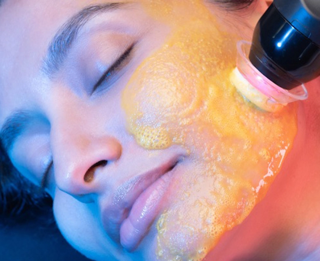 A close-up of a skincare treatment, showcasing a device applying a bright, orange gel to the skin. The background features vibrant colors.